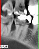 Röntgenaufnahme für Parodontologie