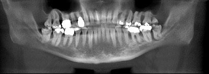 Panoramaaufnahme Parodontologie